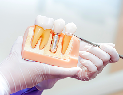 Savannah Cosmetic Dentist